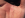 burnt hand.png