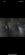 IMG_1711.PNG