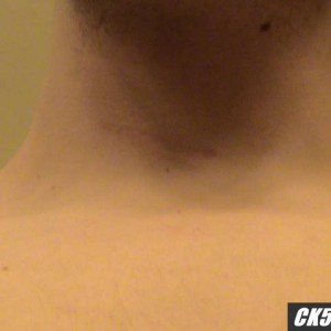 neck f & r