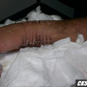 ouch