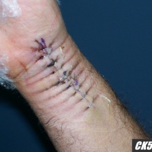 bottom of the wrist