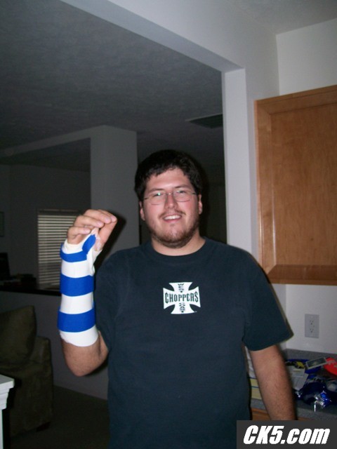 clamshell splint