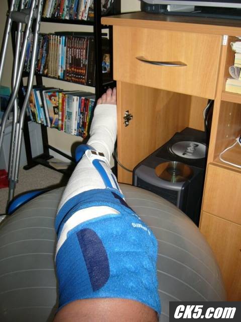 leg