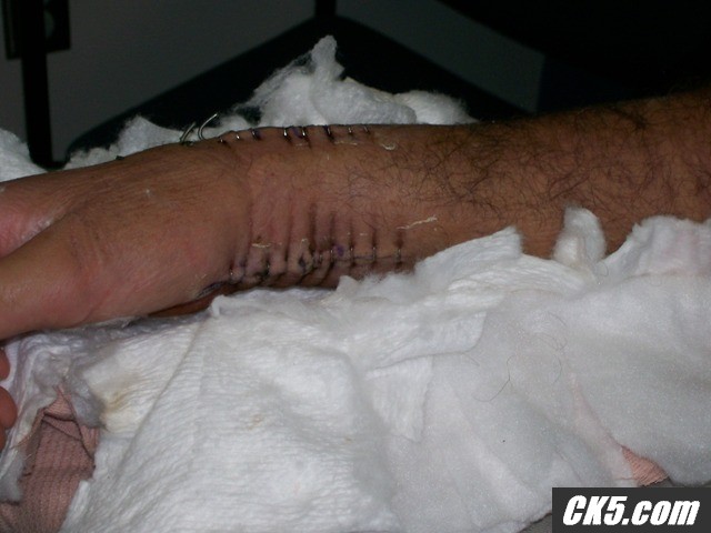 ouch