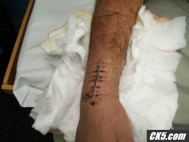ouch