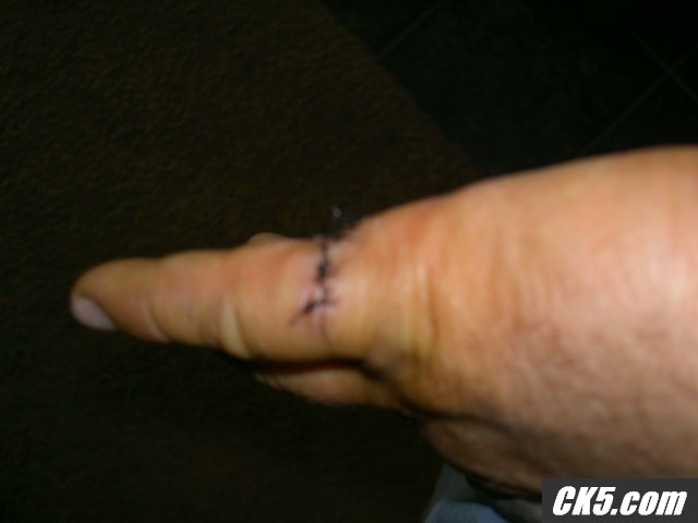 Picture_525