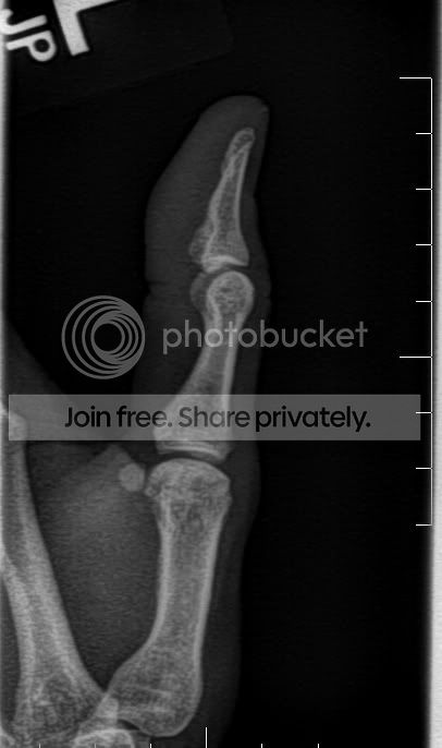 LThumb01.jpg